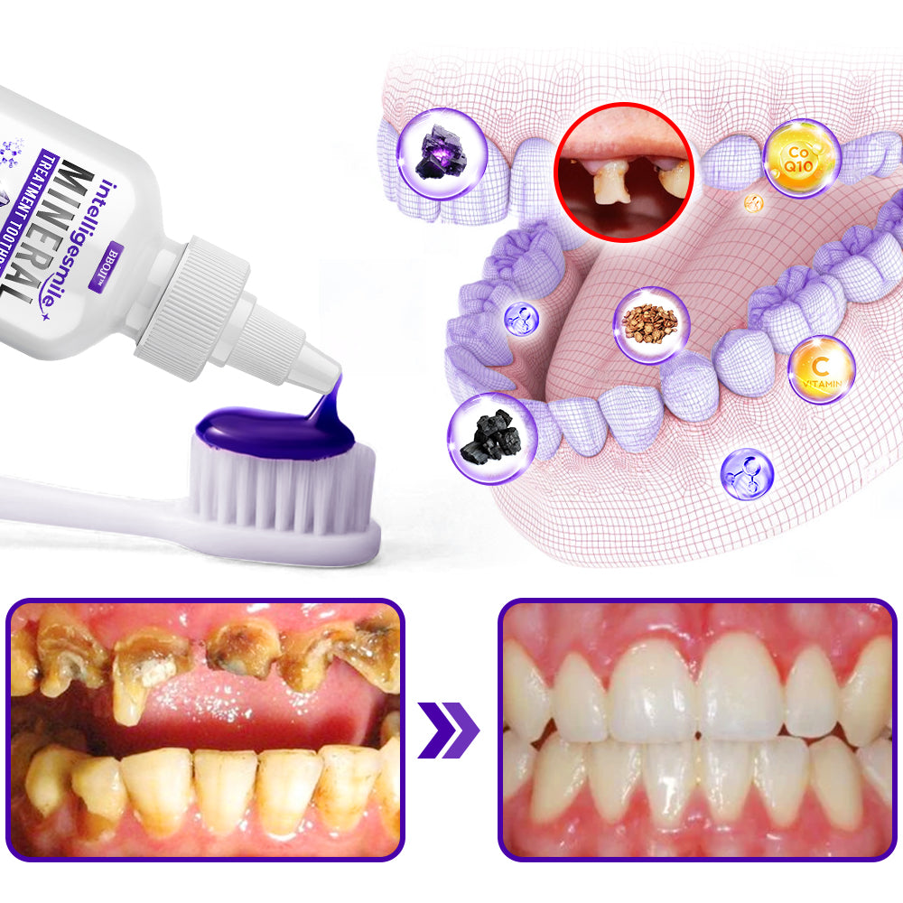 🥇 BBOJI™ Dentifricio IntelligeSmile con Trattamento Minerale (🇦🇺 Consigliato ADA)