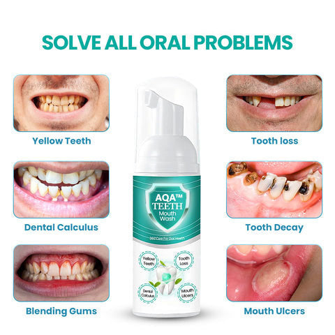 🔥 ULTIMO GIORNO - SCONTO DEL 70% 🔥 AQA™ COLLUTORIO NEW TEETH - Risolve tutti i problemi del cavo orale