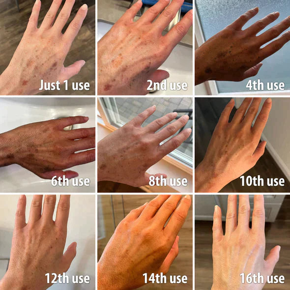 (🔥Promozione ultimo giorno 70% DI SCONTO) Fast Dark Spot Remover-AQA™ Melanin Correcting Facial Serum