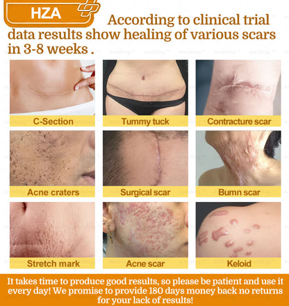 HZA𝟕-𝐃𝐚𝐲 𝐑𝐚𝐩𝐢𝐝 𝐒𝐤𝐢𝐧 𝐑𝐞𝐩𝐚𝐢𝐫 𝐂𝐫𝐞𝐚𝐦 𝐔𝐊 𝐃𝐞𝐫𝐦𝐚𝐭𝐨𝐥𝐨𝐠𝐢𝐬𝐭 𝐀𝐩𝐩𝐫𝐨𝐯𝐞𝐝 (💎💎𝐁𝐀𝐃 𝐑𝐄𝐂𝐎𝐌𝐌𝐄𝐍𝐃𝐄𝐃)
