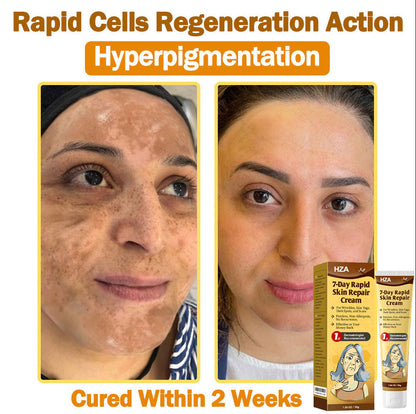 HZA𝟕-𝐃𝐚𝐲 𝐑𝐚𝐩𝐢𝐝 𝐒𝐤𝐢𝐧 𝐑𝐞𝐩𝐚𝐢𝐫 𝐂𝐫𝐞𝐚𝐦 𝐔𝐊 𝐃𝐞𝐫𝐦𝐚𝐭𝐨𝐥𝐨𝐠𝐢𝐬𝐭 𝐀𝐩𝐩𝐫𝐨𝐯𝐞𝐝 (💎💎𝐁𝐀𝐃 𝐑𝐄𝐂𝐎𝐌𝐌𝐄𝐍𝐃𝐄𝐃)