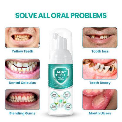 🔥 ULTIMO GIORNO - SCONTO DEL 70% 🔥 AQA™ COLLUTORIO NEW TEETH - Risolve tutti i problemi del cavo orale