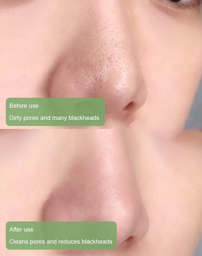 Lovilds™ Maschera al Tè Verde per una Pulizia Profonda e Pori Impercettibili